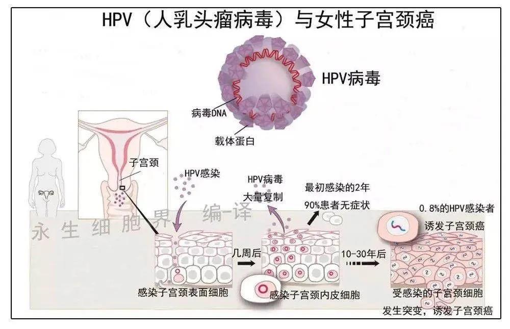 HPV检查呈阳性，我是不是得宫颈癌了？