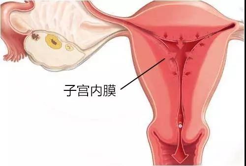 子宫内膜癌已跃居妇科恶性肿瘤位，七大高危因素需警惕