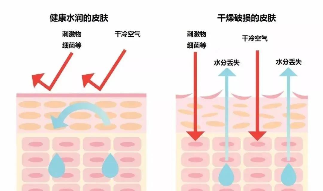 三伏天到来，宝宝长湿疹or痱子傻傻分不清楚？