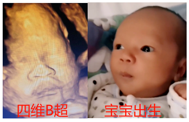还没出生就被亲妈嫌弃？宝宝：你看我还有机会吗
